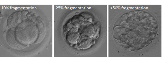 Examples of graded day three embryos